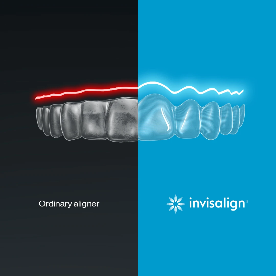 invisalign